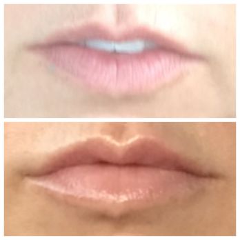 Tucson Cosmetics - Cosmetic Surgeons Near Me - Tucson, Arizona