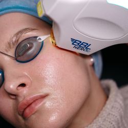 Face Forward Aesthetics - Unlock your most radiant skin ever with BBL HEROic laser treatment.