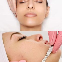 HALO Healing Therapies - The dermaplaning add on is a great way to up level your skin game.