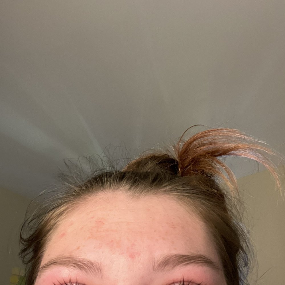 about 25% of my natural lashes left after Neha's method of applying extensions pulled out 75% of my natural lashes about 25% of my natural lashes left after Neha's method of applying extensions pulled out 75% of my natural lashes