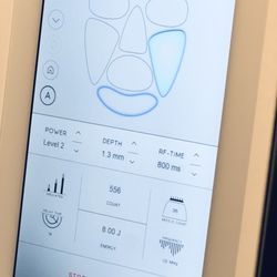 Manhattan Aesthetics - New vivace ultra treatment