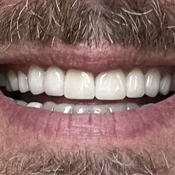 Abdul N. Shaikh, DMD - Premier Dentistry - After