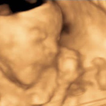 Prenatal Angels - A lovely 4D ultrasound of this yawning cutie pie! Book your next ultrasound on our website today - Ultrasound Imaging Centers Near Me - Lakewood, California Prenatal Angels - A lovely 4D ultrasound of this yawning cutie pie! Book your next ultrasound on our website today - Ultrasound Imaging Centers Near Me - Lakewood, California