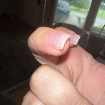 Sky Salon - Cut up cuticle and glue - Nail Salons Near Me - Mount Pleasant, Michigan Sky Salon - Cut up cuticle and glue - Nail Salons Near Me - Mount Pleasant, Michigan