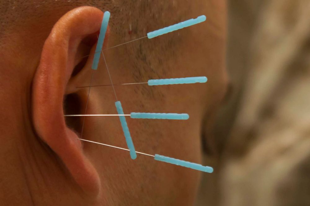 BRONX WELLNESS ACUPUNCTURE & MASSAGE Updated April 2024 28 Photos & 61 Reviews 2510