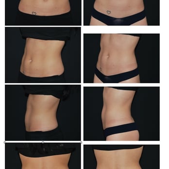 Adam Lowenstein - Cosmetic Surgeons Near Me - Santa Barbara, California