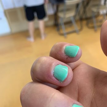 Donna's Nail & Spa - All over my skin and more cuticle issues - Nail Salons Near Me - New Hyde Park, New York