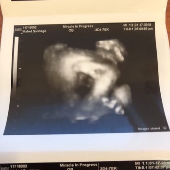 Miracle In Progress Ultrasound - Diagnostic Imaging Near Me - Mullica Hill, New Jersey Miracle In Progress Ultrasound - Diagnostic Imaging Near Me - Mullica Hill, New Jersey