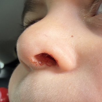 Rockin' Kids Play Center - My kid came down the slide and hit his nose on the net wall because the slide area is literally so short you end up in the wall. - Kids Activities Near Me - Simi Valley, California Rockin' Kids Play Center - My kid came down the slide and hit his nose on the net wall because the slide area is literally so short you end up in the wall. - Kids Activities Near Me - Simi Valley, California