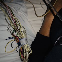 Southern California Sleep Disorders Specialists - Wires on the side
