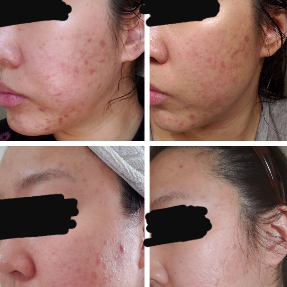 Bruce S Park, MD - Same chronological order as last photo - Dermatologists Near Me - Fullerton, California Bruce S Park, MD - Same chronological order as last photo - Dermatologists Near Me - Fullerton, California