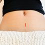 Photo of Calabasas Acupuncture