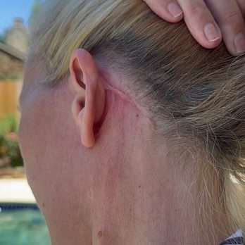 Blackledge Face Center - More scars - Cosmetic Surgeons Near Me - Jackson, Mississippi
