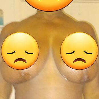 Avana Plastic Surgery - Stay away from avana Dr meminkis is bad business RUN - Cosmetic Surgeons Near Me - Miami, Florida Avana Plastic Surgery - Stay away from avana Dr meminkis is bad business RUN - Cosmetic Surgeons Near Me - Miami, Florida