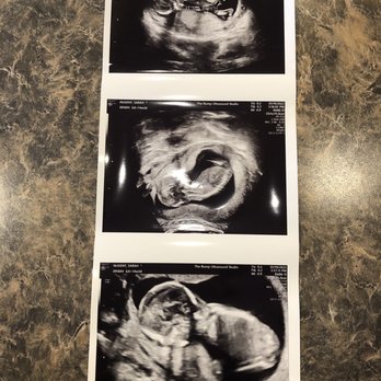 The Bump Ultrasound Studio - Diagnostic Imaging Near Me - Niles, Michigan The Bump Ultrasound Studio - Diagnostic Imaging Near Me - Niles, Michigan