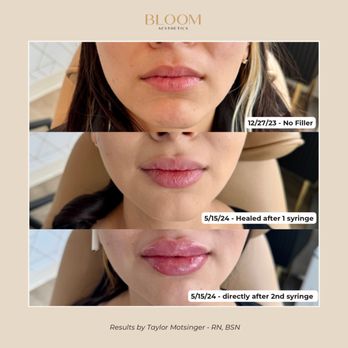 Bloom Aesthetics by Zelda - Medical Spas Near Me - Spokane, Washington Bloom Aesthetics by Zelda - Medical Spas Near Me - Spokane, Washington