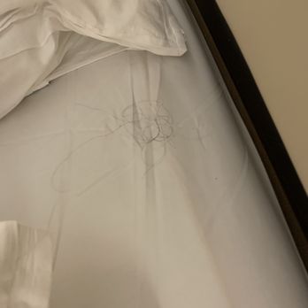 Sheraton Fallsview Hotel - Hair in bed - Hotels Near Me - Niagara Falls, Ontario Sheraton Fallsview Hotel - Hair in bed - Hotels Near Me - Niagara Falls, Ontario