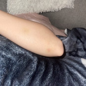 Kelley O'Neil's - Bruises from being thrown - Music Venues Near Me - Honolulu, Hawaii Kelley O'Neil's - Bruises from being thrown - Music Venues Near Me - Honolulu, Hawaii