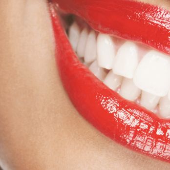 True Shine - Contagious white teeth. See more on my Instagram page @contagious_whiteteeth - Teeth Whitening Near Me