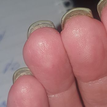 Central Beauty - My nails from Tuesday 4/1/2022 at Central Beauty Mt Barker.  Not happy, Jan. And NO I'm not a Karen!! - Nail Salons Near Me - Mount Barker, SA