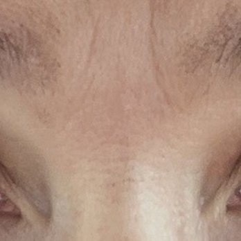 MegaLash Studio - After - Eyelash Service Near Me - Downers Grove, Illinois