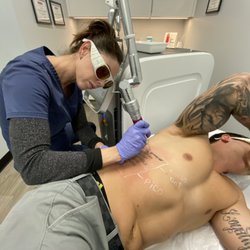 Inkfree, MD Laser Clinic - Advanced PicoPlus Tattoo Removal