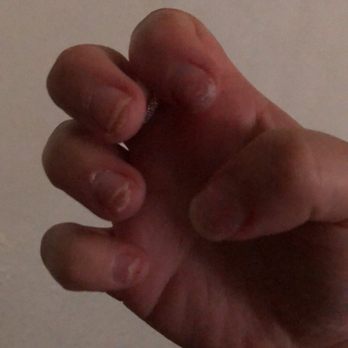 Elegant Nails - My real nails after taking off the fake nails - Nail Salons Near Me - Anaheim, California Elegant Nails - My real nails after taking off the fake nails - Nail Salons Near Me - Anaheim, California