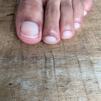 Ivy Nails & Spa - This is my left foot also bleeding there - Nail Salons Near Me - Lansing, Michigan
