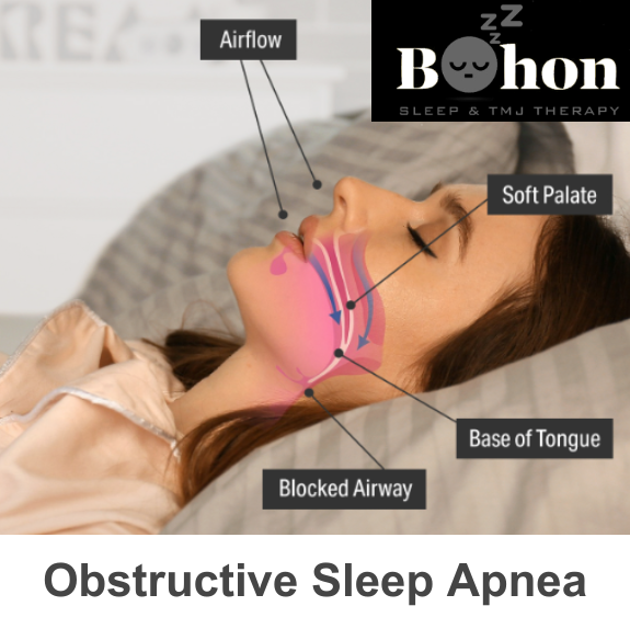 Bohon Sleep and TMJ Therapy - sleep specialist in Columbia, MO