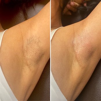 Eve Waxing Studio - Under arm Waxing - Waxing Near Me - Shenandoah, Texas Eve Waxing Studio - Under arm Waxing - Waxing Near Me - Shenandoah, Texas