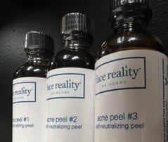 Chemical Peels Services! - We do all types of Chemical Peels like Anti-Aging Peel, Customized PCA, Pigment Peel and Post-Acne Peel Services! Chemical Peels Services! - We do all types of Chemical Peels like Anti-Aging Peel, Customized PCA, Pigment Peel and Post-Acne Peel Services!