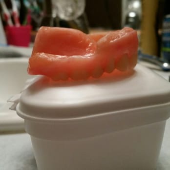Aspen Dental - Gainesville, GA - This is the healing denture I am left to live with - Oral Surgeons Near Me - Gainesville, Georgia Aspen Dental - Gainesville, GA - This is the healing denture I am left to live with - Oral Surgeons Near Me - Gainesville, Georgia