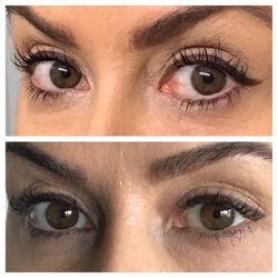 Alexis Rose Beauty - TOP/BEFORE: Healthy long lashes prior to service  BOTTOM/AFTER: Broken, brittle lashes 2 weeks after service