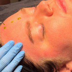 Body by Shae - Reveal fresh, glowing skin with BioRePeel! This no-peel chemical peel brightens, smooths, and rejuvenates with zero downtime.