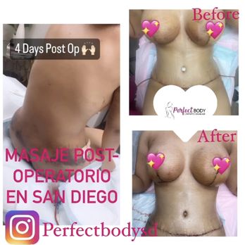 Perfect body sd - Massage Therapy Near Me