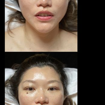 Marina Skincare - Nano therapy - Skin Care Near Me Marina Skincare - Nano therapy - Skin Care Near Me