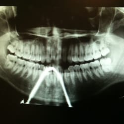 Capital Oral & Maxillofacial Surgery - Panoramic X-rays!