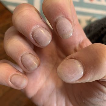 Lynn's Salon - Cracked middle and pointer finger, horrific cuticles - Hair Salons Near Me - Chandler, Arizona