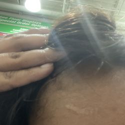 Hair Professionals Career College - Scar from 2 years ago