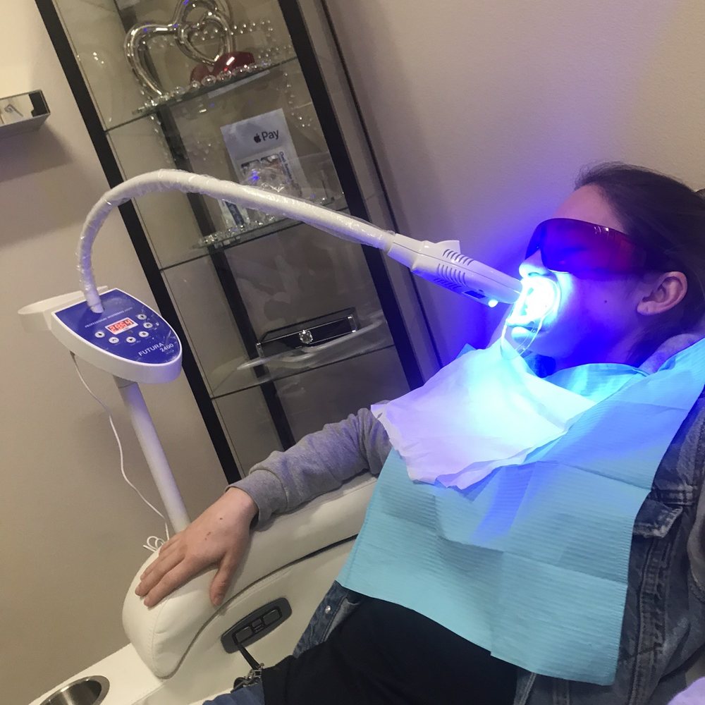 Illumination Teeth Whitening - The girlfriend getting her pearls shined ! - Teeth Whitening Near Me - Diamond Bar , California
