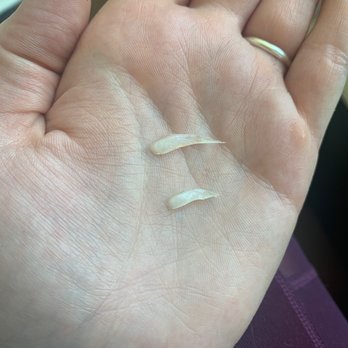 Amazona's Pizza - Weird plastic in prosciutto pizza. - Pizza Near Me - Oakland, California
