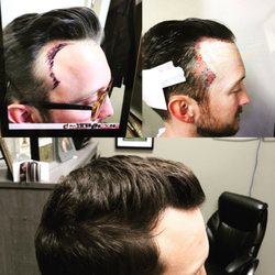 Robotic Hair Institute - Hair lowering is all the rage. With ARTAS and Robotic Hair Institute, you can expect permanent and natural results.