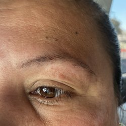 Grace eyebrow threading - Cut on upper lid, horrible job