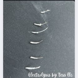 Electrolysis By Tess