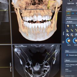 Kaleka Dental - 3D imaging