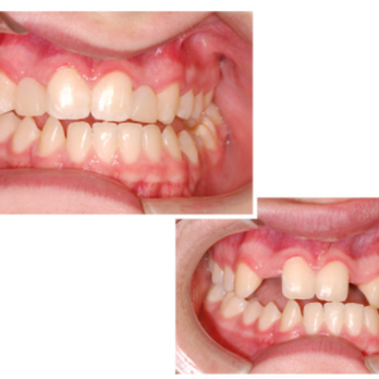 Janice E Spada, DMD - Cosmetic Dentists Near Me - Sudbury, Massachusetts