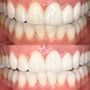Photo of Haute Smile Co