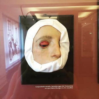 Medizinhistorisches Museum der Charité - Conjunctiva - Museums Near Me - Berlin, BE