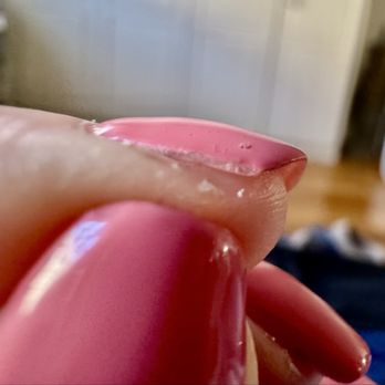 Modern Spa - This photo speaks for itself, and representative of many nails, many gel manicures. Never again. - Nail Salons Near Me - New York, New York