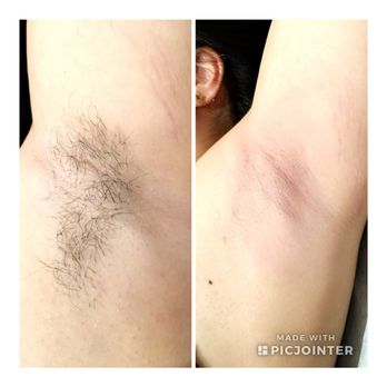 Michelle G Image Studio - Underarm clean up - Waxing Near Me - Woodland Hills, California Michelle G Image Studio - Underarm clean up - Waxing Near Me - Woodland Hills, California